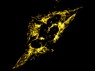 Innovative technology provides new insights into the development of serious diseases