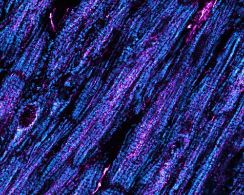 Vorhofflimmern: Gestörte Kalzium-Kommunikation bringt das Herz aus dem Takt
