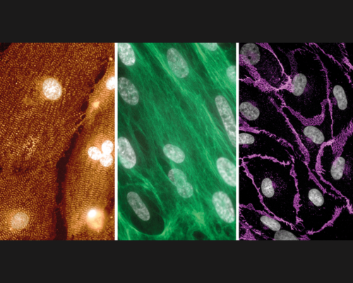 New insights into Noonan syndrome