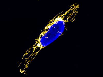 Tempokontrolle bei der mitochondrialen Proteinproduktion entdeckt