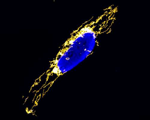 Tempokontrolle bei der mitochondrialen Proteinproduktion entdeckt